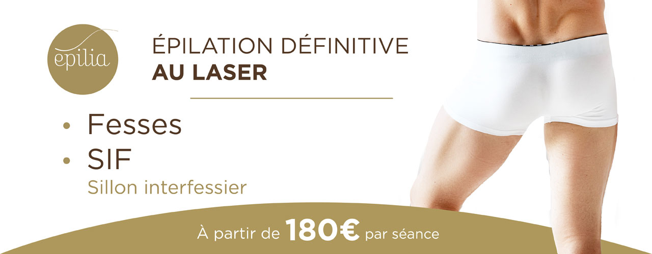 epilation-laser-femmes-sif-homme-waterloo