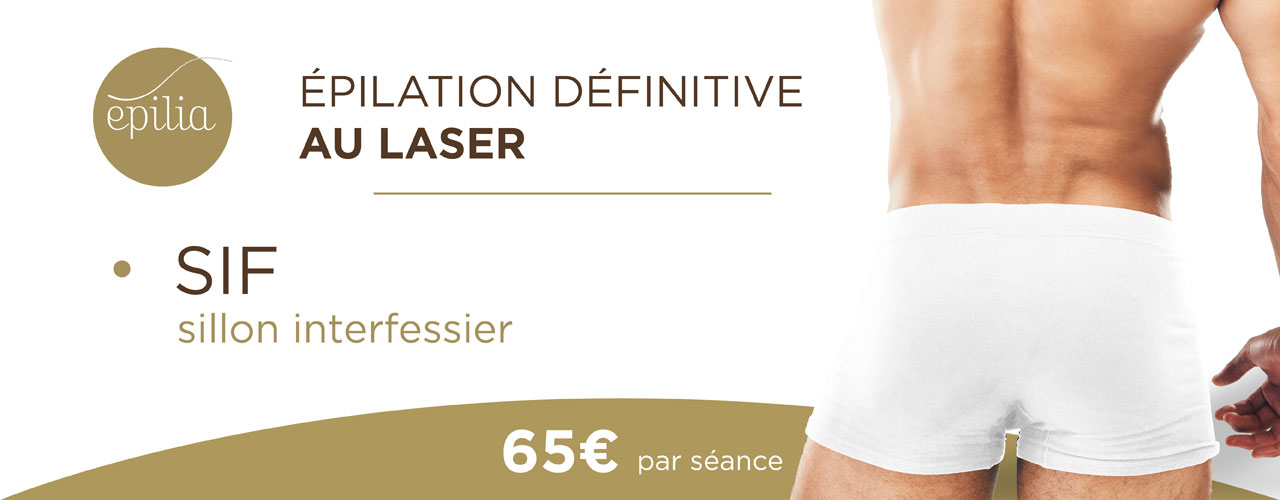 epilation-laser-sif-homme-waterloo