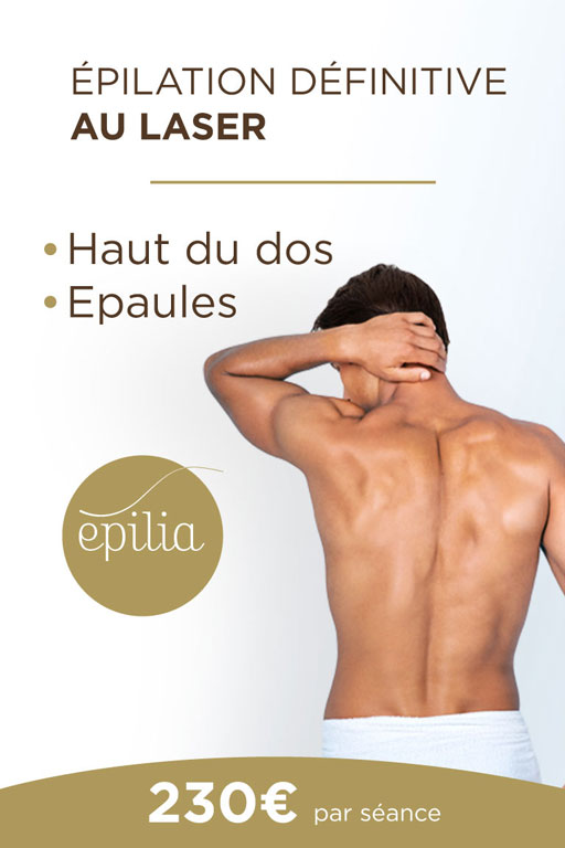 epilation-laser-haut-dos-epaules-waterloo-mob